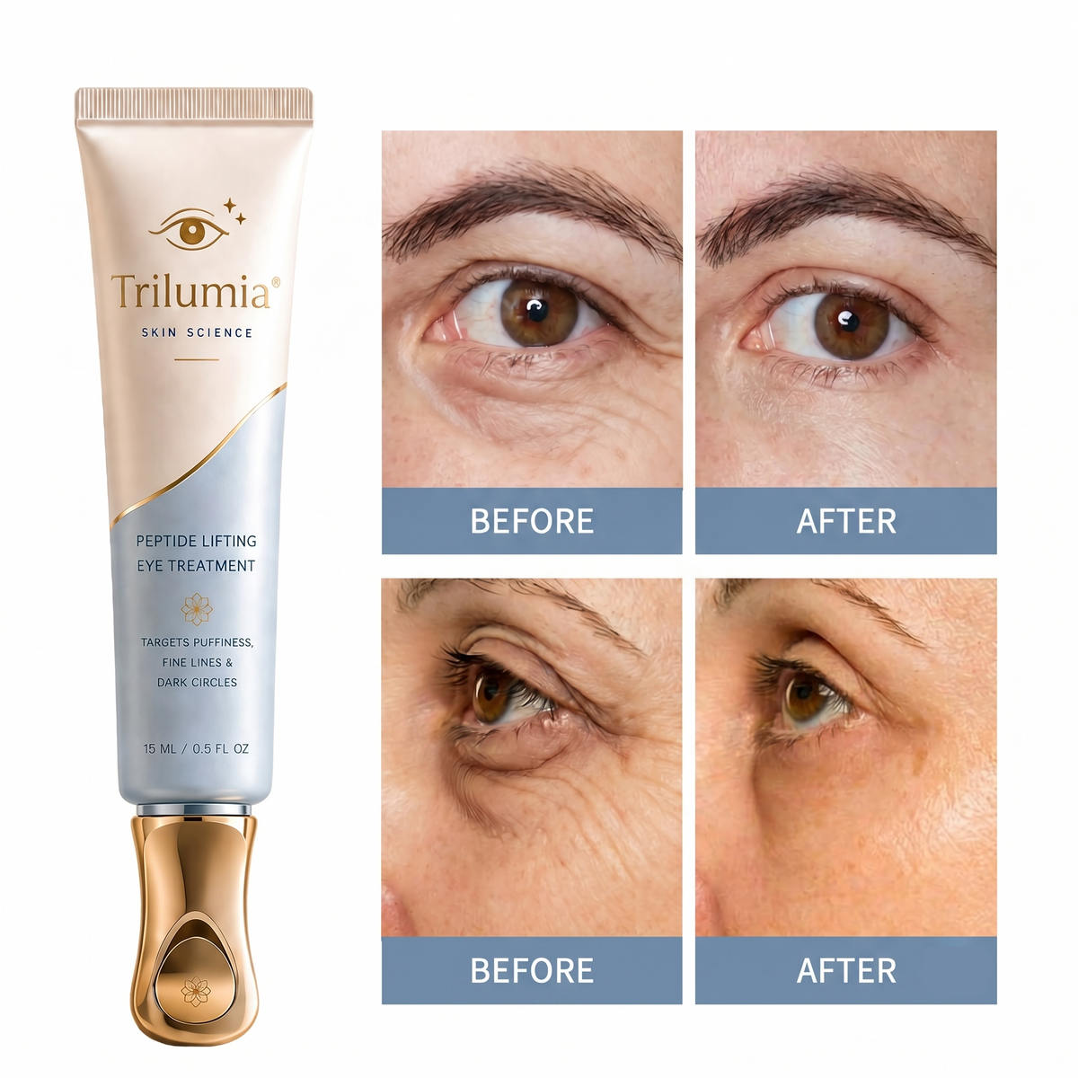 Trilumia SKIN SCIENCE PEPTIDE LIFTING EYE TREATMENT TARGETS PUFFINESS